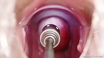 Amateur Blonde Gets Her Holes Stretched By A Doctor